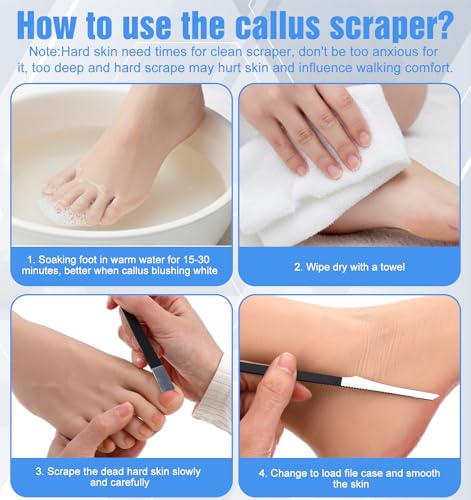 7-Piece Pedicure Knife Set Stainless Steel Callus & Corn Remover Tool Kit