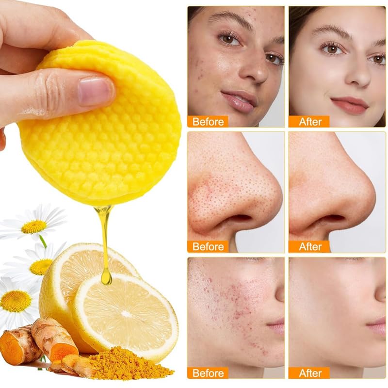 Mustio Turmeric Kojic Acid Cleansing Pads - Dark Spot Corrector & Exfoliating Face Pads 50pcs