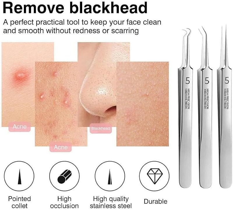 Jizlan 3-Piece Professional Blackhead Removal Tweezer Set Stainless Steel