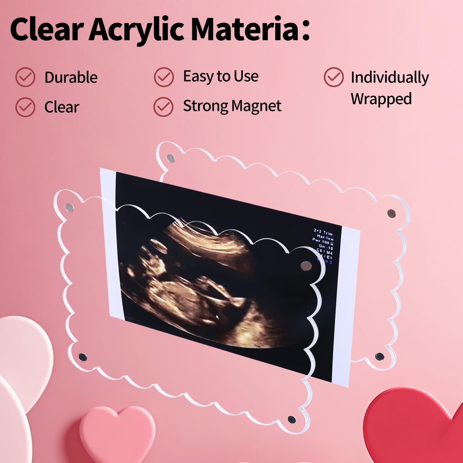 Mlatnod Magnetic Clear Acrylic Scalloped Baby Ultrasound Picture Frame - Sonogram Frame for Refrigerator, Display for Pregnancy Announcement, Gender Reveal & Expecting Parents Gifts(No Stand)