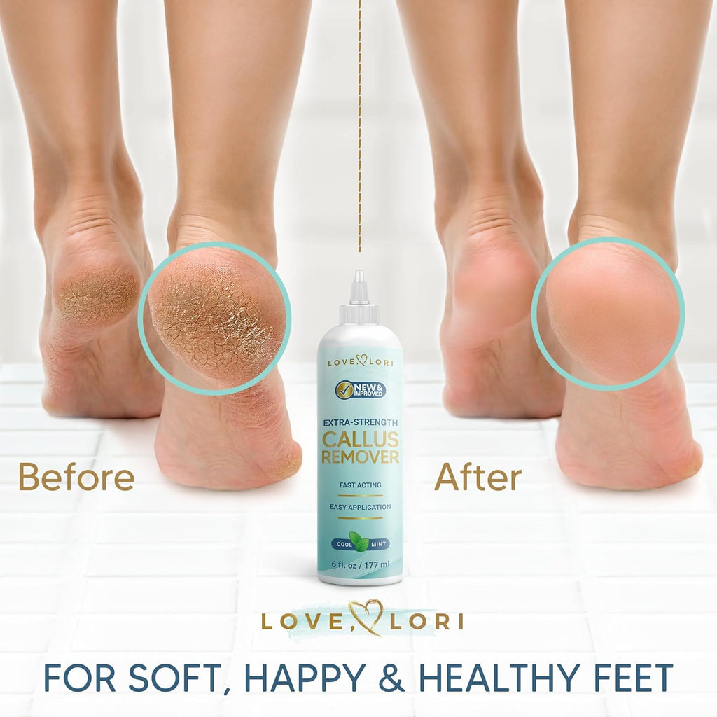 Regine Switzerland Callus Remover Gel - Extra Strength Foot Care Scrubber | 6oz Pedicure Essential