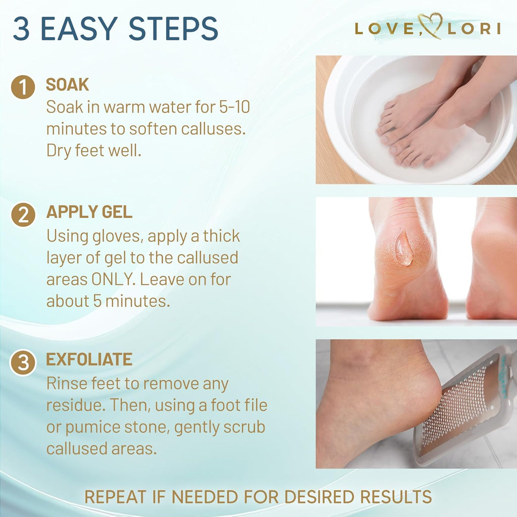 Regine Switzerland Callus Remover Gel - Extra Strength Foot Care Scrubber | 6oz Pedicure Essential