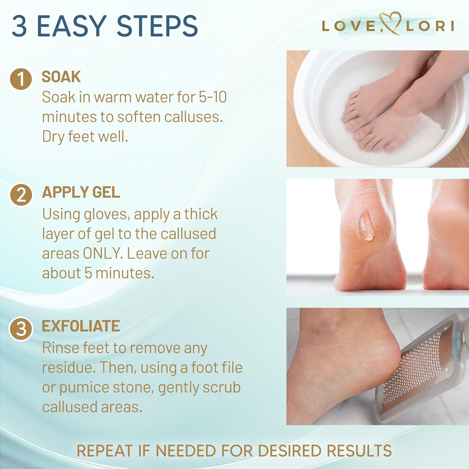 Regine Switzerland Callus Remover Gel - Extra Strength Foot Care Scrubber | 6oz Pedicure Essential
