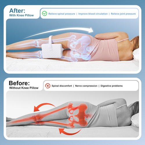 Knee Pillow for Side Sleepers, Leg Pillow for Sciatica, Back, HIPS, Knees, Joints Pain Relief,Pillows for Between Legs While Sleeping Spine Alignment Support & Relieves Pressure,Basic Strap,White