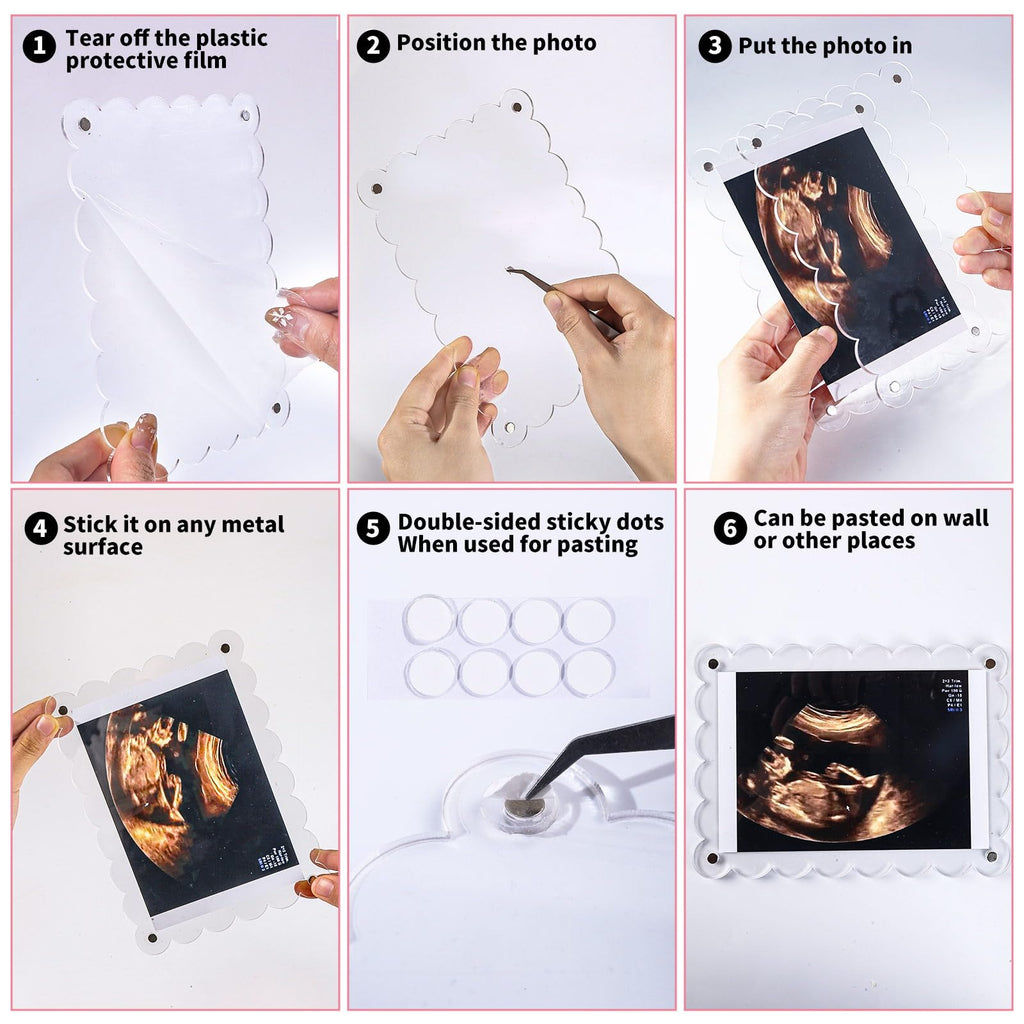 Mlatnod Magnetic Clear Acrylic Scalloped Baby Ultrasound Picture Frame - Sonogram Frame for Refrigerator, Display for Pregnancy Announcement, Gender Reveal & Expecting Parents Gifts(No Stand)