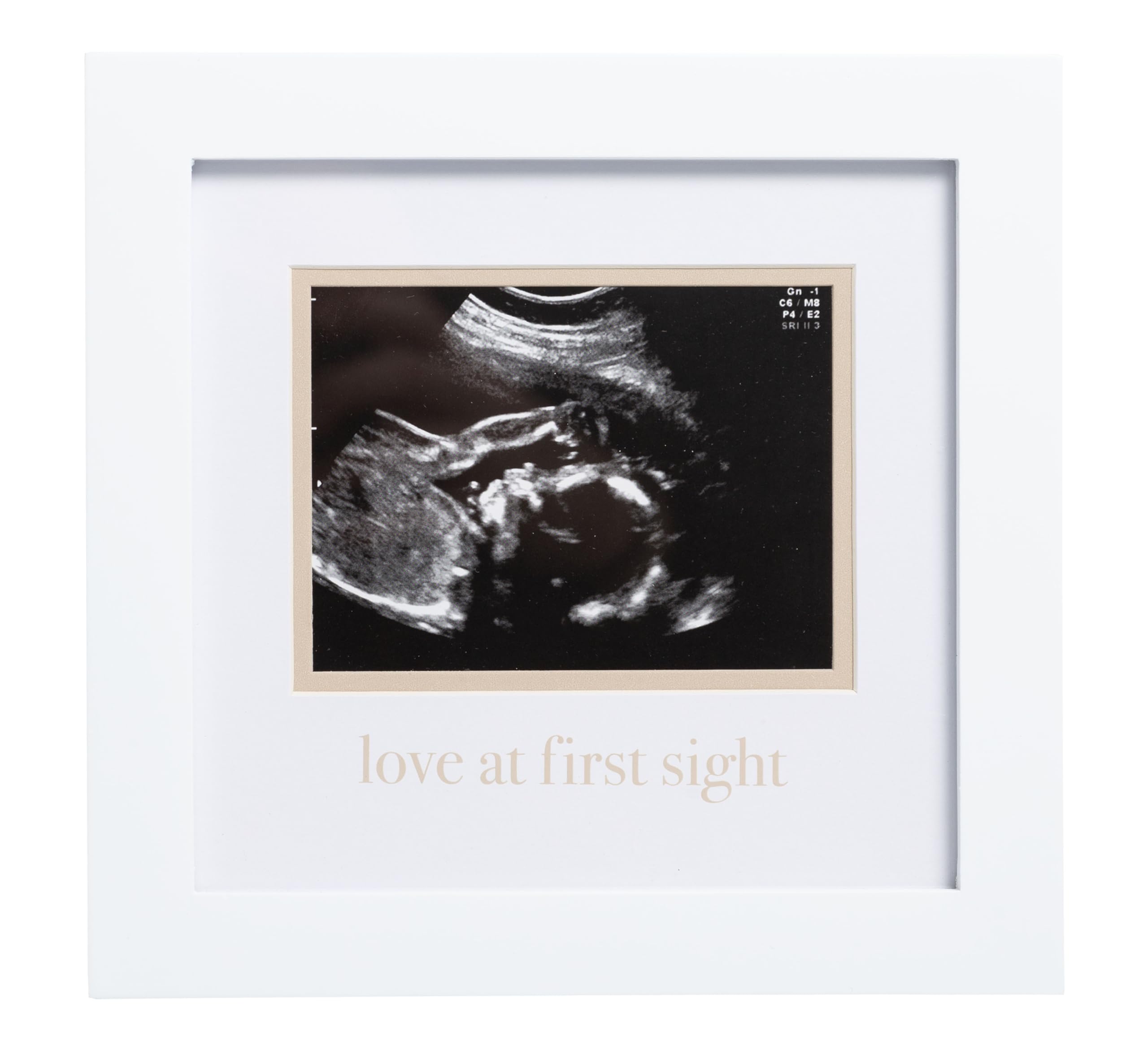 Pearhead Love At First Sight Sonogram Frame, Ultrasound Picture Frame, Pregnancy Announcement Photo Frame, Baby Keepsake Gift For Expecting Parents